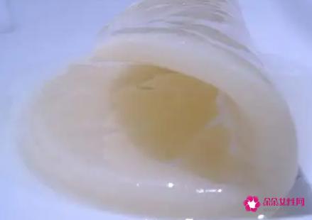 红茶菌的功效
