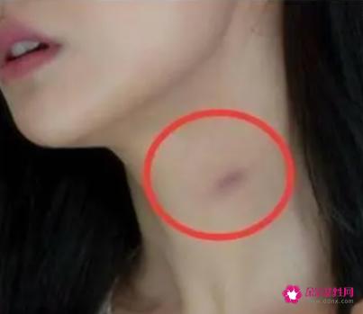 男人喜欢在脖子上种草莓的原因