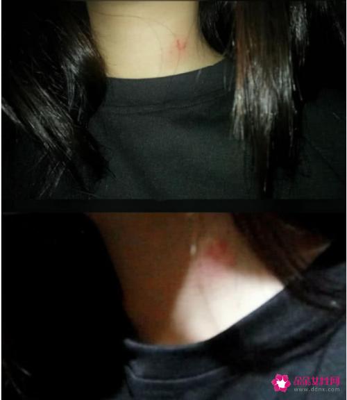 男人喜欢在脖子上种草莓的原因