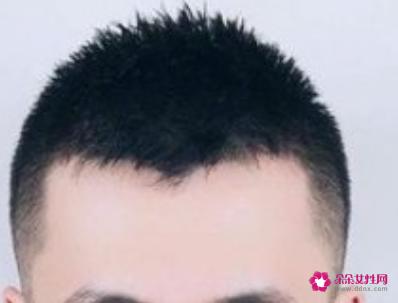 发量少适合什么发型男