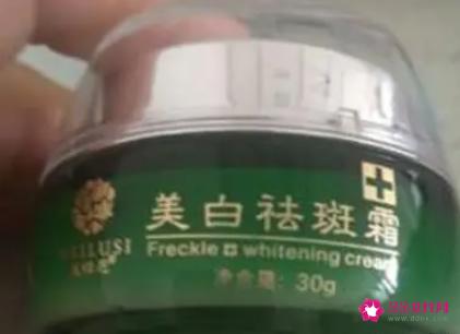 祛斑的好的5种药膏