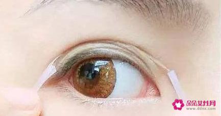 内双是双眼皮还是单眼皮