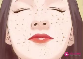 各种类型斑的图片