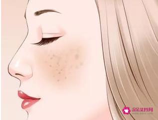 各种类型斑的图片