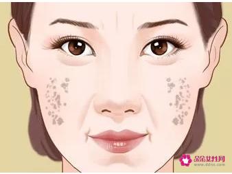 各种类型斑的图片