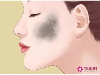 各种类型斑的图片