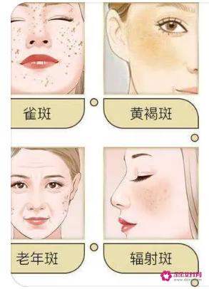 各种类型斑的图片