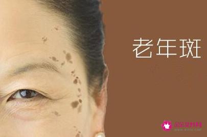 各种类型斑的图片