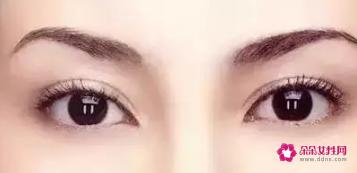 最好看的四种双眼皮图片