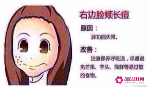 长痘的原因是什么