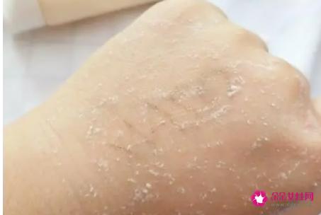 去角质洗面奶