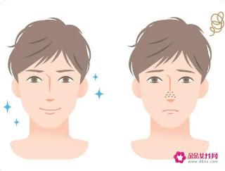 男生该怎么护肤