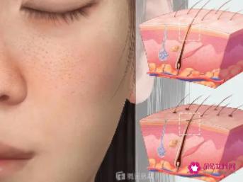 收缩毛孔的十个方法