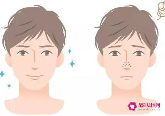 男性脸部保养小知识