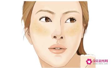 黄褐斑与晒斑最直观区别图片
