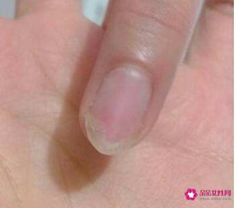 光疗的指甲怎么卸掉