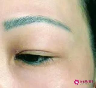 洗眉一般多少钱