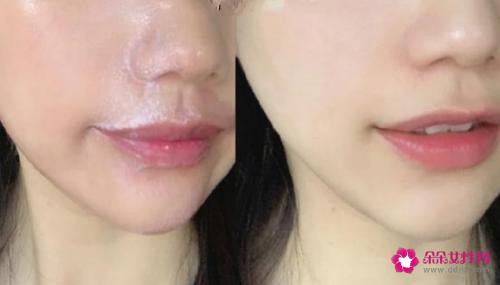 卸妆油哪个牌子好用又不贵