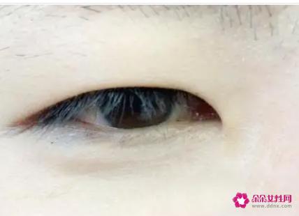 单眼皮是显性还是隐性