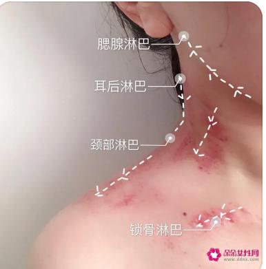 正确的刮痧方法图解