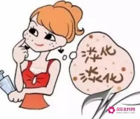 教你几个简单有效的祛斑方法
