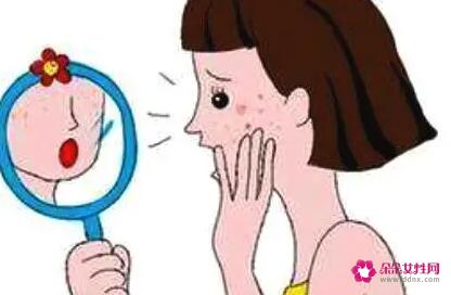 正确有效的抗痘的绝招