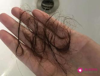 4种防止脱发的食物