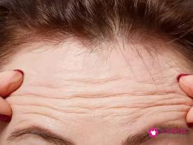 额头上有很多细纹是怎么回事