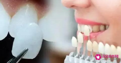 牙齿美容的方法有哪些