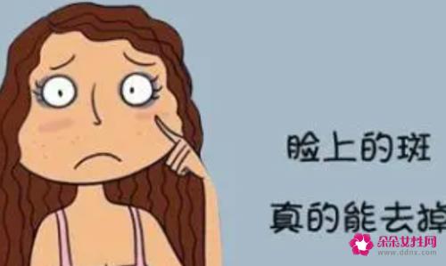 镭射祛斑好不好