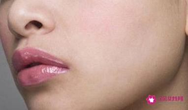 脸色发黄的原因有哪些