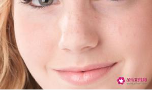 满脸雀斑怎么回事