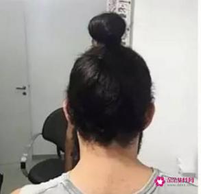 头发少适合什么发型分享