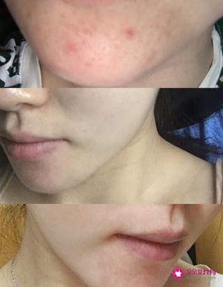 冻干粉的正确使用方法