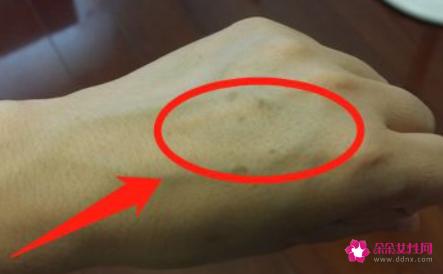 哪些食物可有效去除老年斑