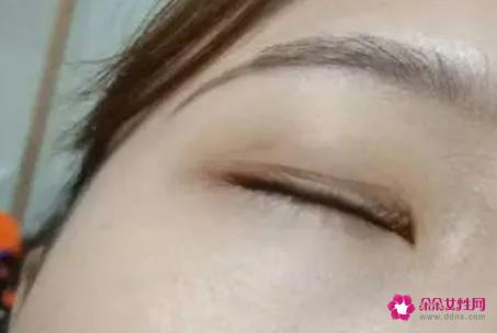 教你贴双眼皮贴内双MM变大眼睛