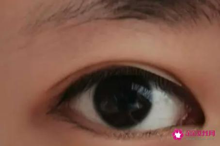 教你贴双眼皮贴内双MM变大眼睛