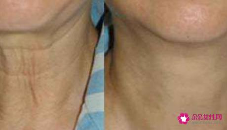 民间美容护肤偏方有哪些