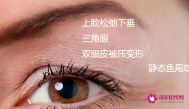 上眼皮松弛恢复锻炼法