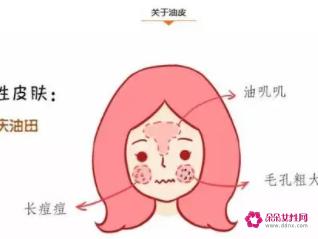 干性皮肤的特征