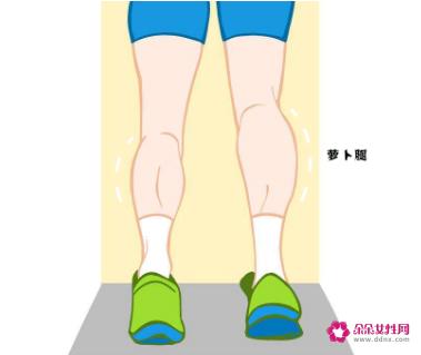 萝卜腿是什么样子的