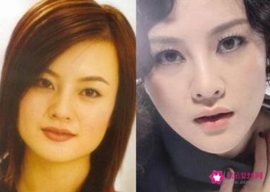 10大女星瘦脸前后妆容大PK