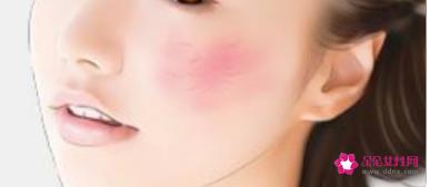 脸上出现红血丝的8种改善方法