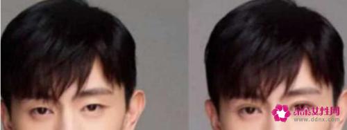 单眼皮比双眼皮有什么好处