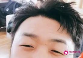 单眼皮比双眼皮有什么好处