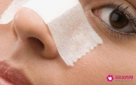 五种去除草莓鼻最有效的方法