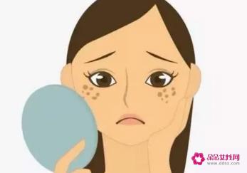 怎么去除雀斑最简单的方法