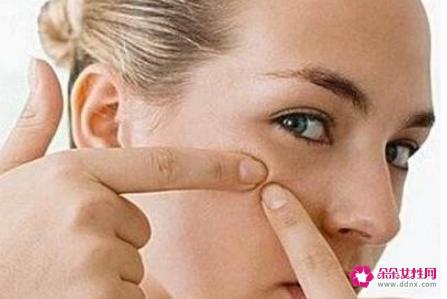 脸上长痘痘怎么排毒呢