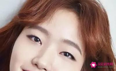 单眼皮和双眼皮哪个好