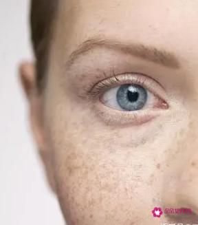 怎样去除斑点小窍门